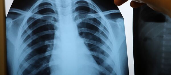 Врач с рентгеном легких в инфекционном корпусе, где лечат пациентов с COVID-19 - Sputnik Moldova