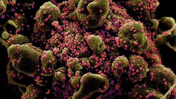 Вид на зараженную коронавирусом клетку под микроскопом - Sputnik Moldova-România