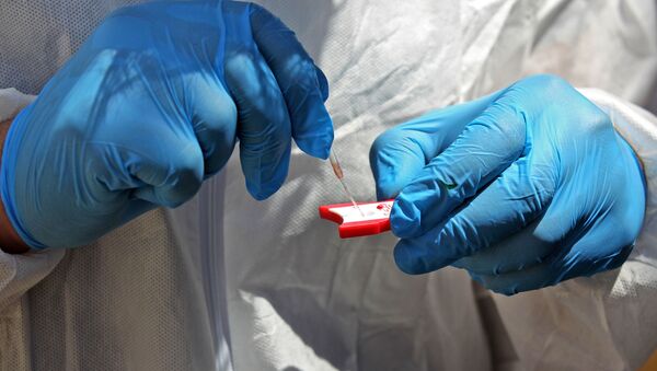 медик применяет проверки образца крови - Sputnik Moldova