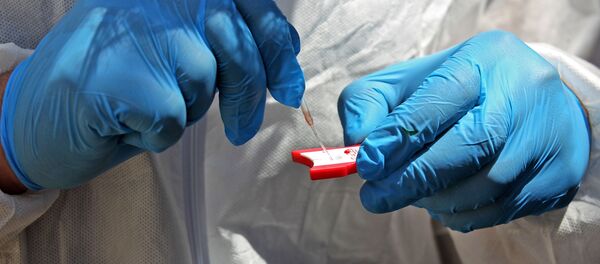 медик применяет проверки образца крови - Sputnik Moldova