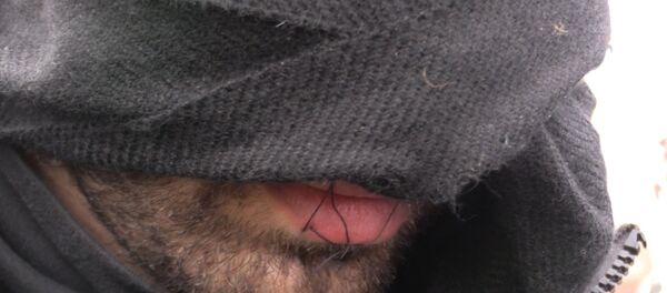 Спутник_Беженцы с зашитыми ртами протестовали против сноса лагеря мигрантов в Кале - Sputnik Молдова