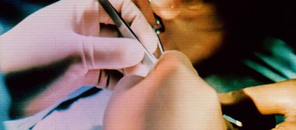 Феномен Акчурина: как хирург руки пришивал - Sputnik Молдова