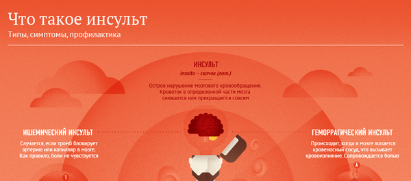 Что такое инсульт и как его избежать - Sputnik Молдова